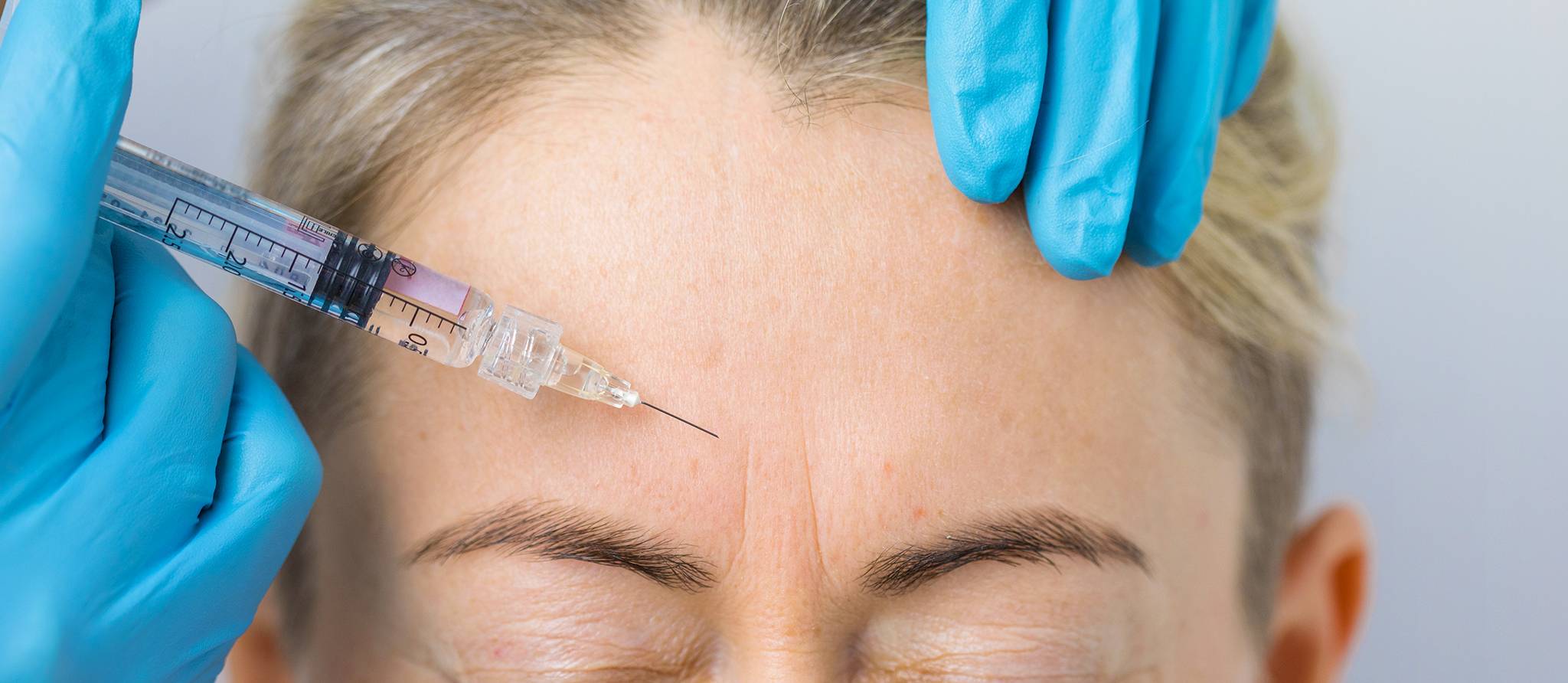 Injections antirides : remplissent-elles leurs promesses ?