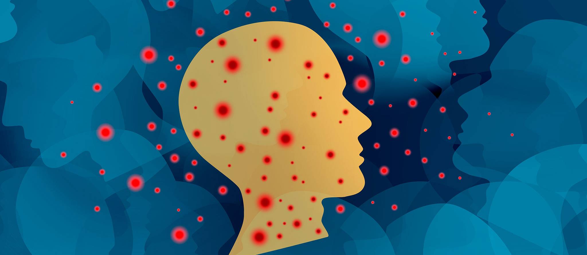 Le Canada perd son statut de pays exempt de rougeole