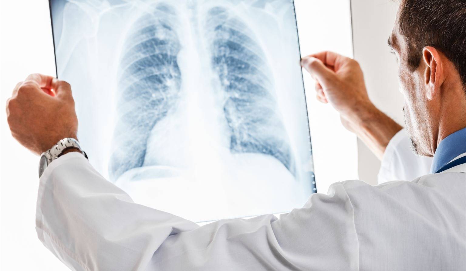 Système de santé: trop de radiologies inutiles?