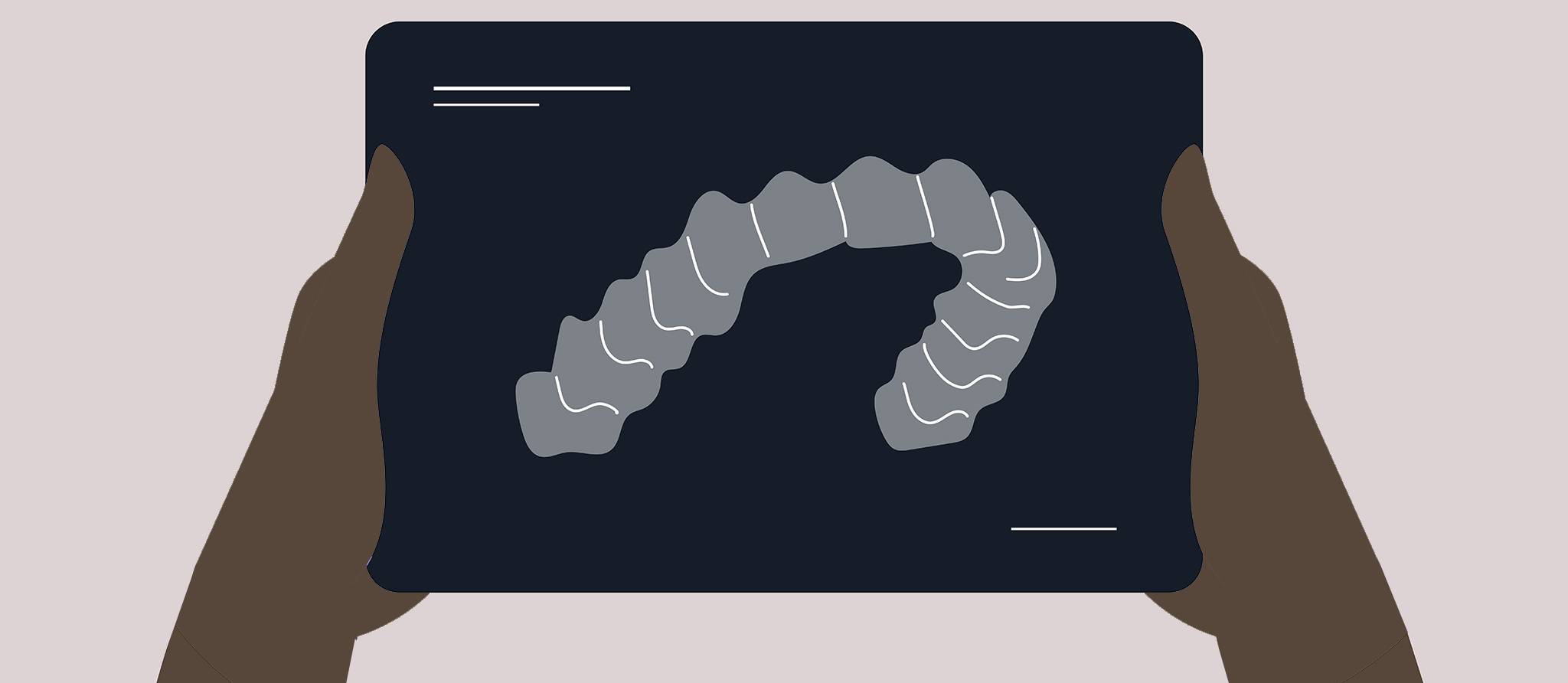L’orthodontie en ligne, une bonne idée?