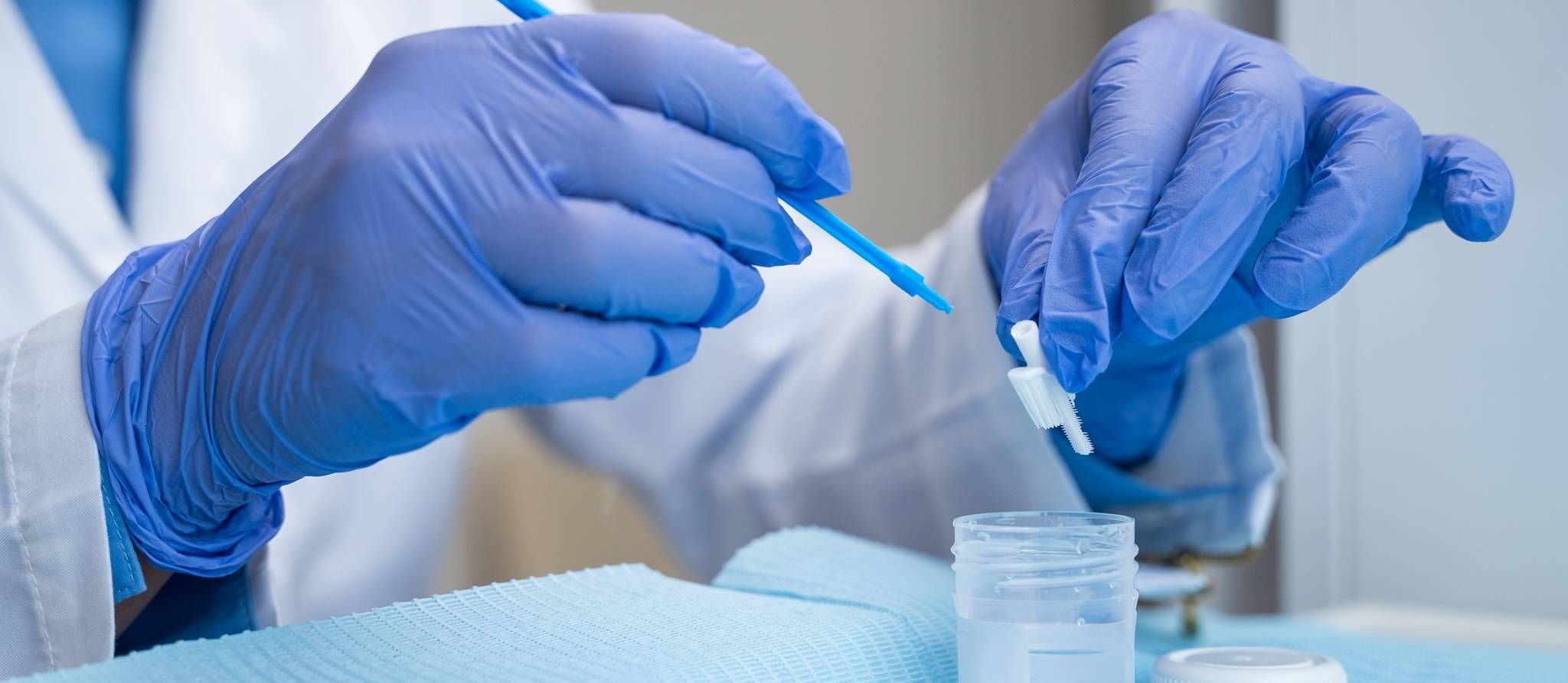 Dépistage du cancer du col de l'utérus: 13 régions ont remplacé le test Pap par le test VPH