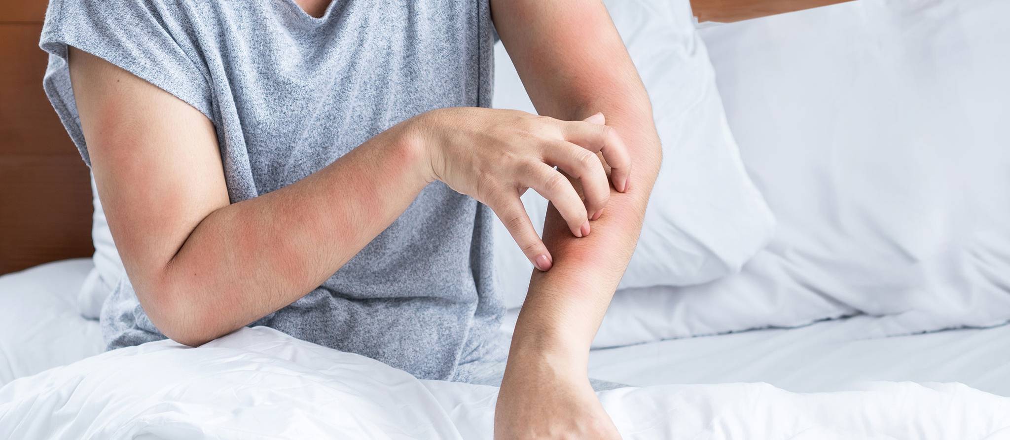 Comment vous débarrasser des punaises de lit