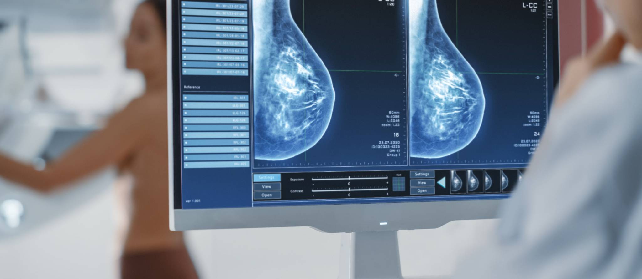 Cancer : le dépistage sauve plus de vies