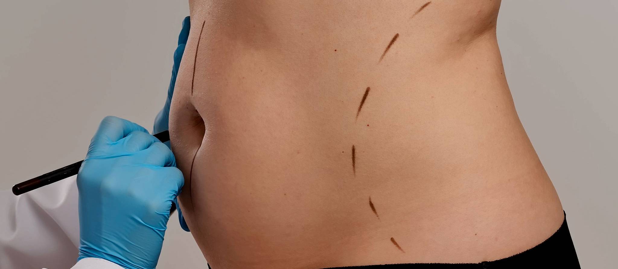 Génération bistouri: bienfaits et dérives de la chirurgie esthétique