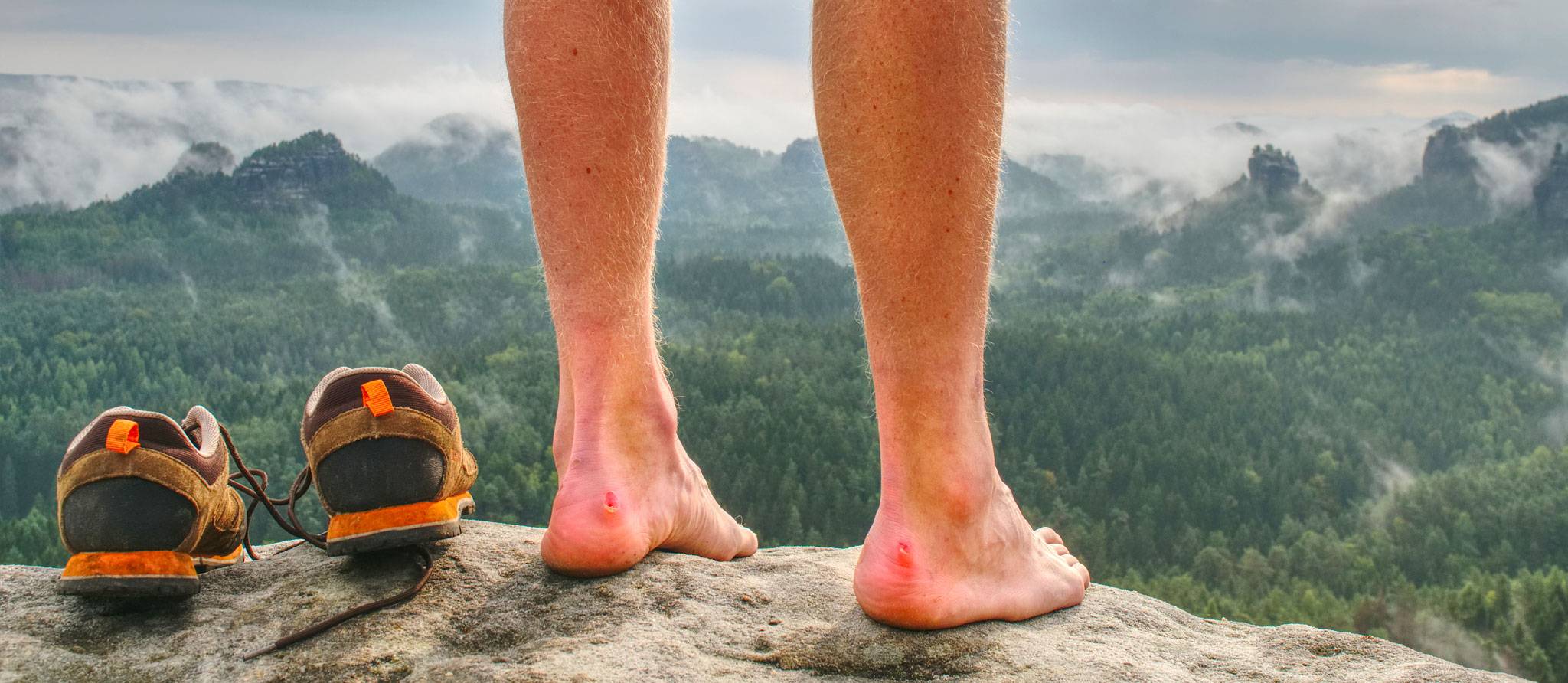 Prévenir et soigner les ampoules aux pieds