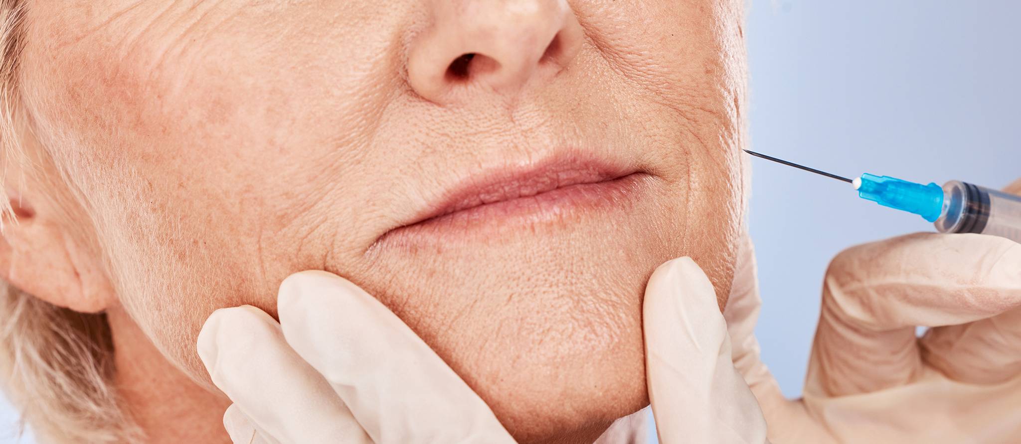 5 conseils pour des injections esthétiques réussies