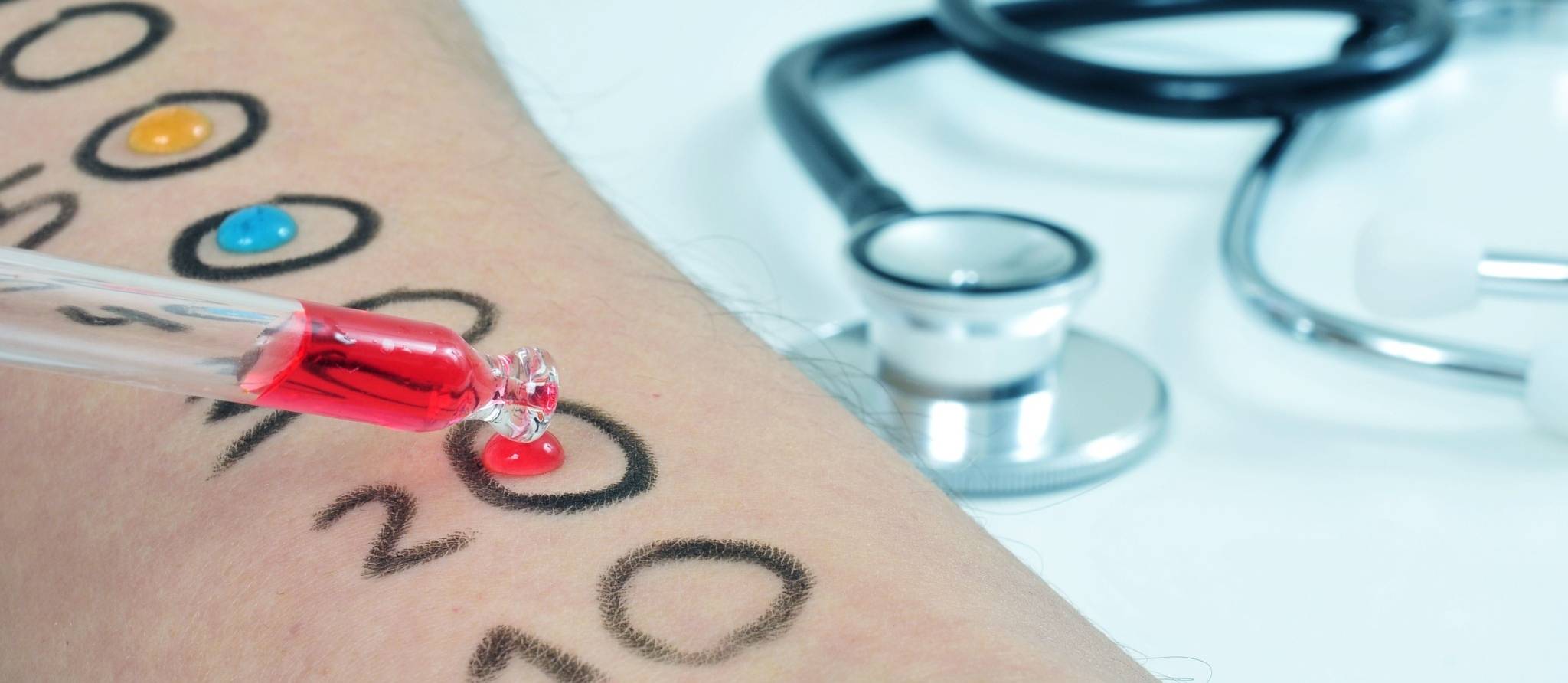 La désensibilisation peut-elle faire disparaitre les allergies ?
