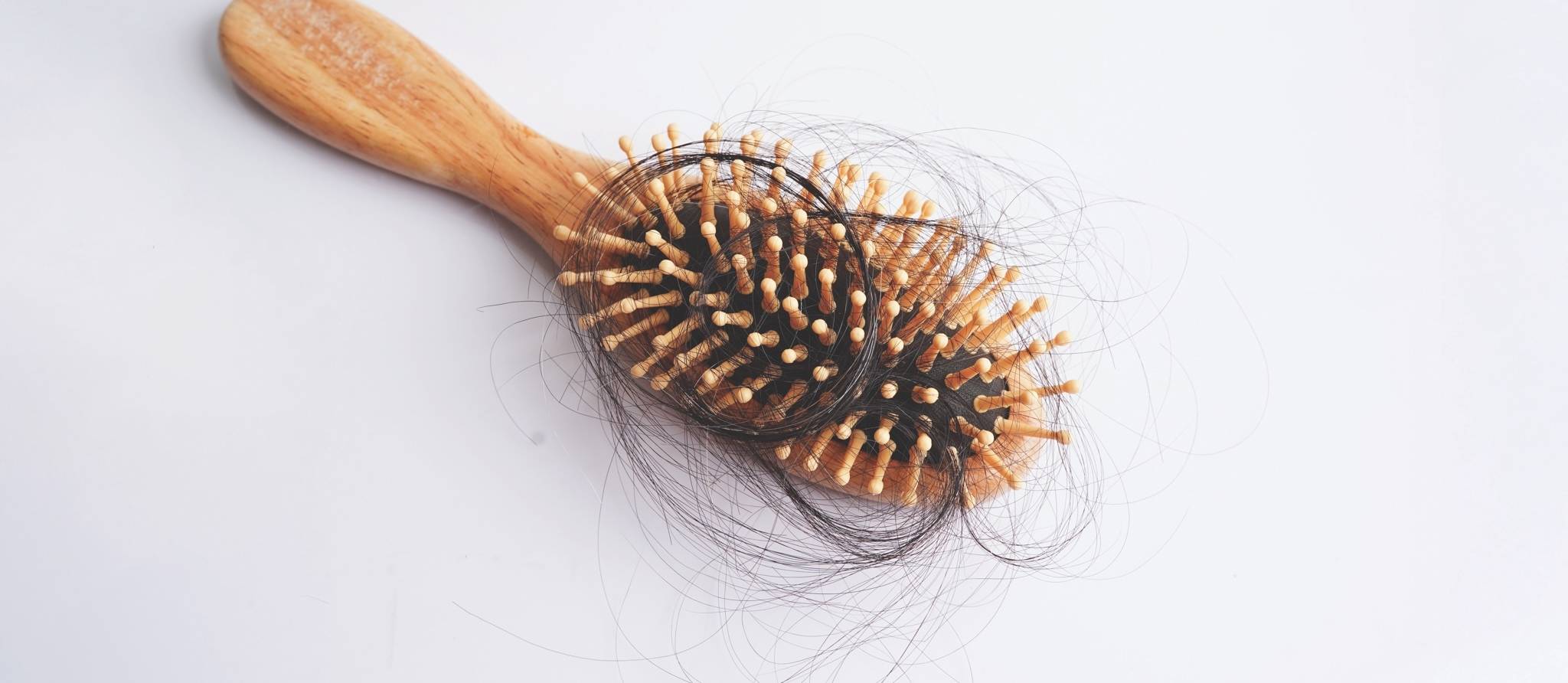 Comment traiter l'alopécie (perte de cheveux chez les femmes)