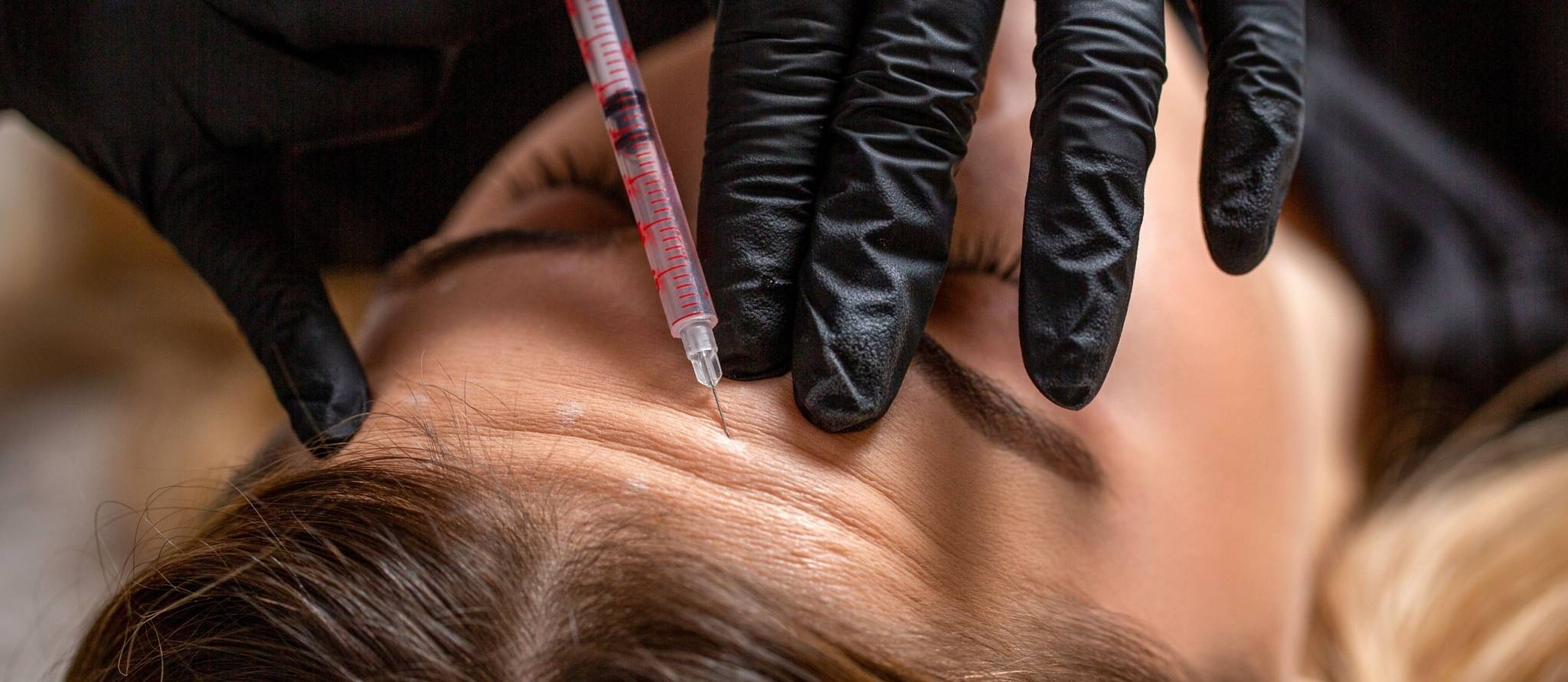 Quatre ordres professionnels veulent de meilleurs soins médico-esthétiques