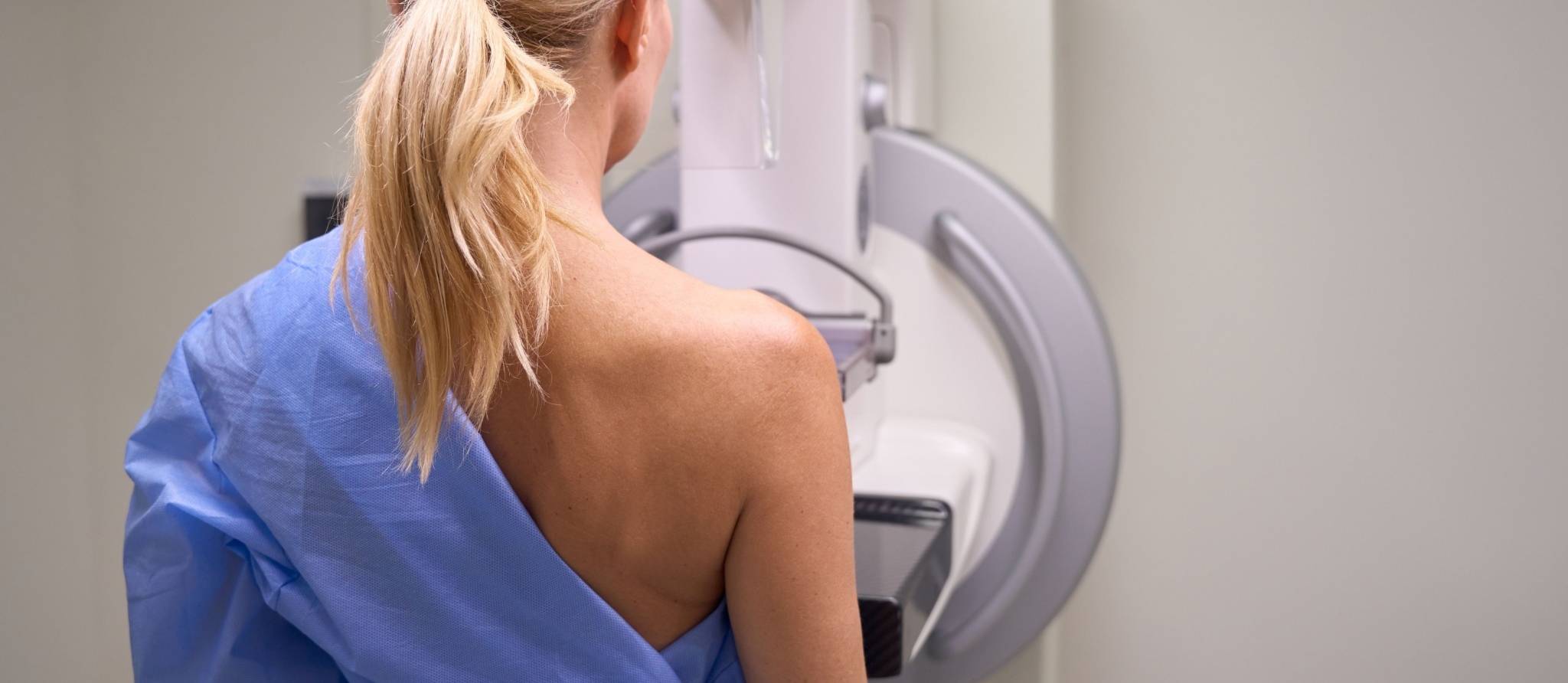 Cancer du sein: la mammographie dès 40 ans?