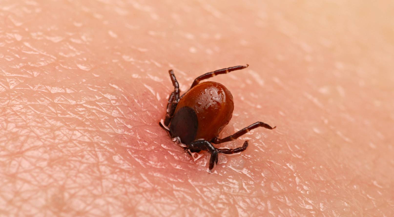 Piqure d’insecte au Québec : quand faut-il s’inquiéter?