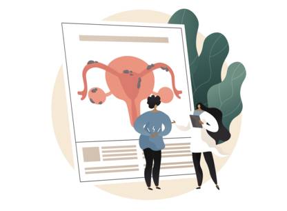 endometriose