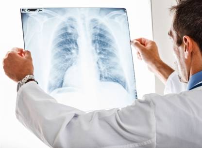 Systeme de sante trop de radiologies inutiles
