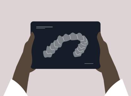 orthodontie-en-ligne