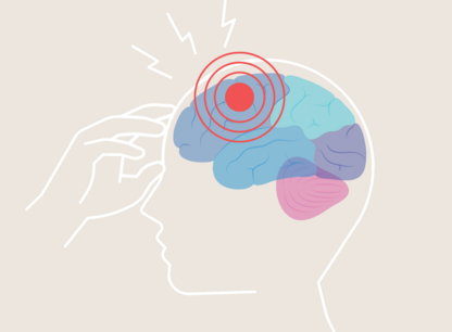 migraines