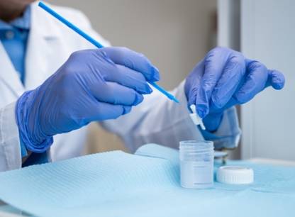 13 régions ont remplacé le test Pap par le test VPH