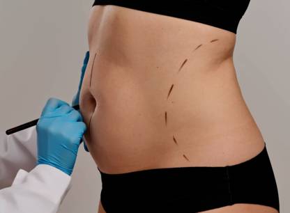 Génération bistouri: bienfaits et dérives de la chirurgie esthétique